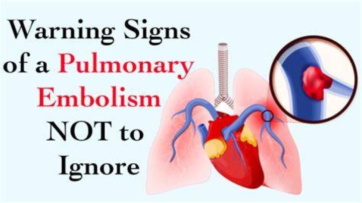Are there warning signs before a pulmonary embolism?