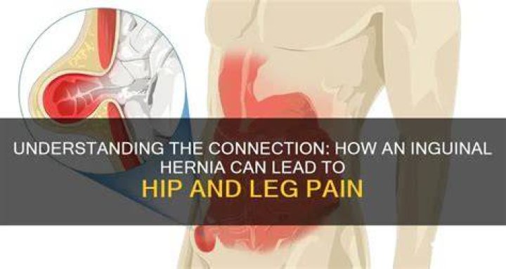 Can a hernia cause hip pain?