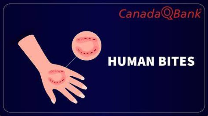 Can humans bite through bone?