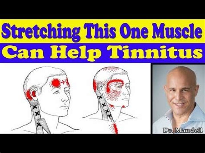 Can tight neck muscles cause tinnitus?