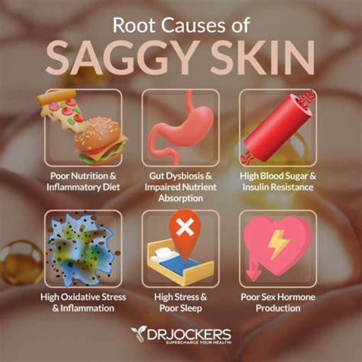 Do vegans have saggy skin?
