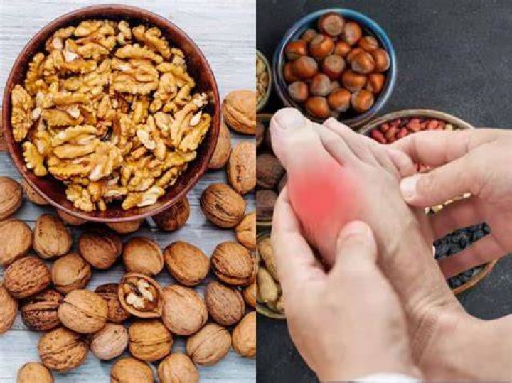Do walnuts increase uric acid?
