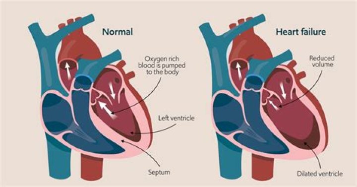 Does congestive heart failure show up in blood work?