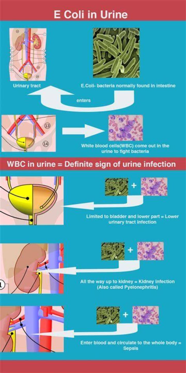 How do you get E. coli infection in your kidneys?