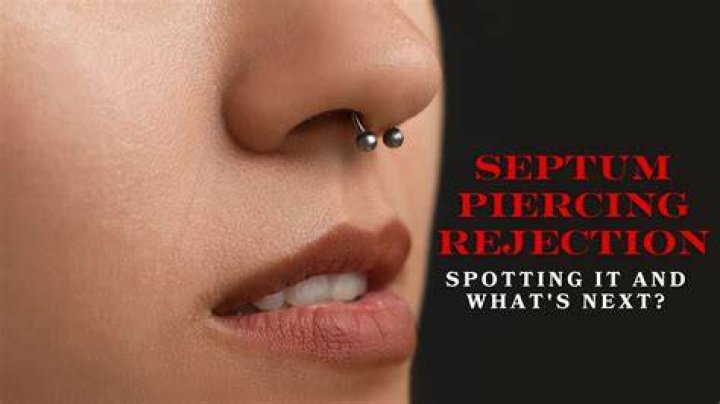How do you know if your septum piercing is rejecting?