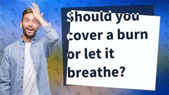 Should you cover a burn or let it breathe?