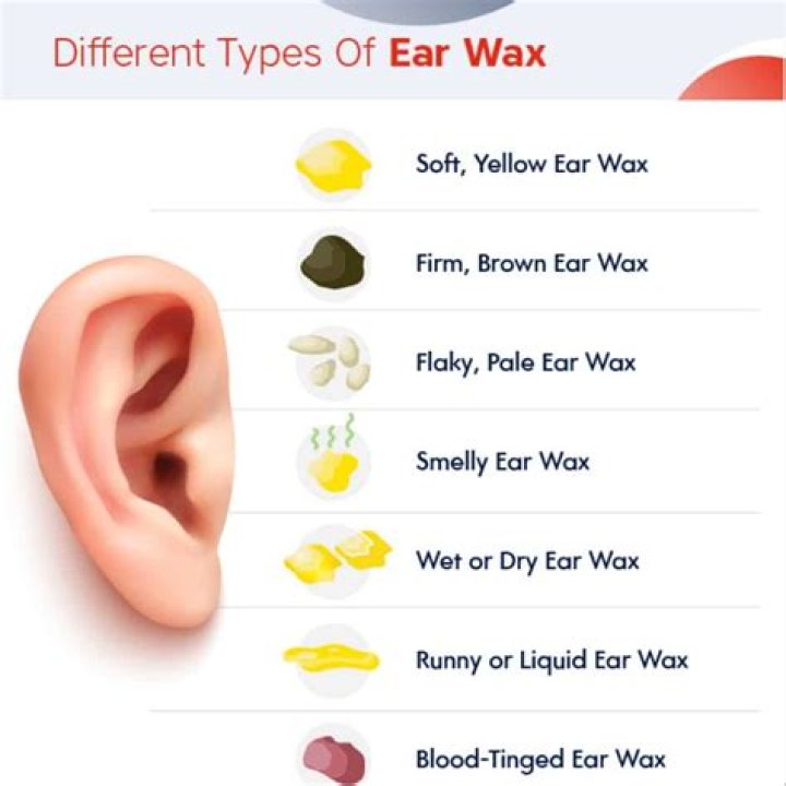 Should you remove earwax?