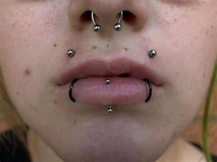What are angel bites?