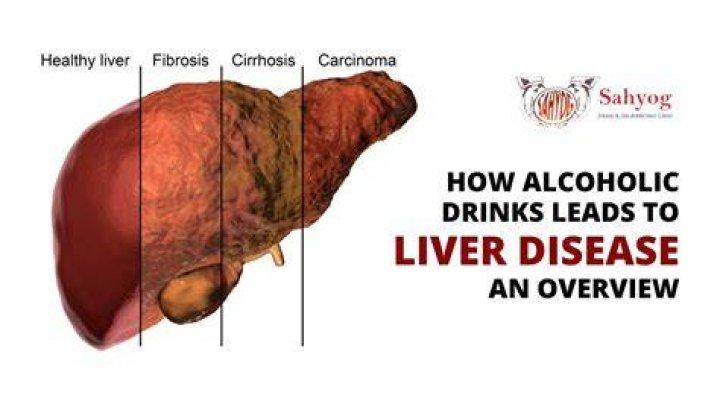 What beer is best for your liver?