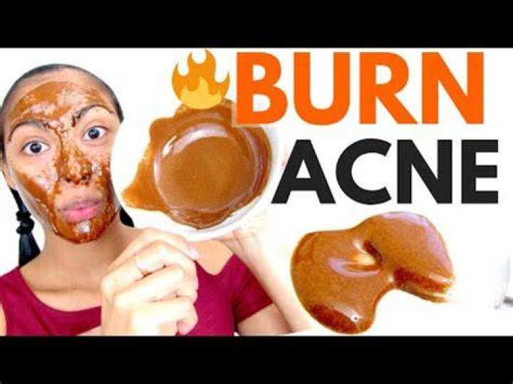 What does honey and cinnamon do to your face?