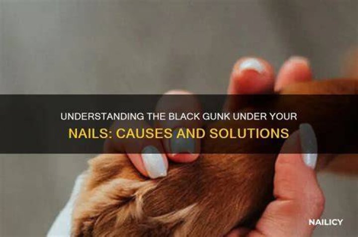 What is the gunk under your toenails?