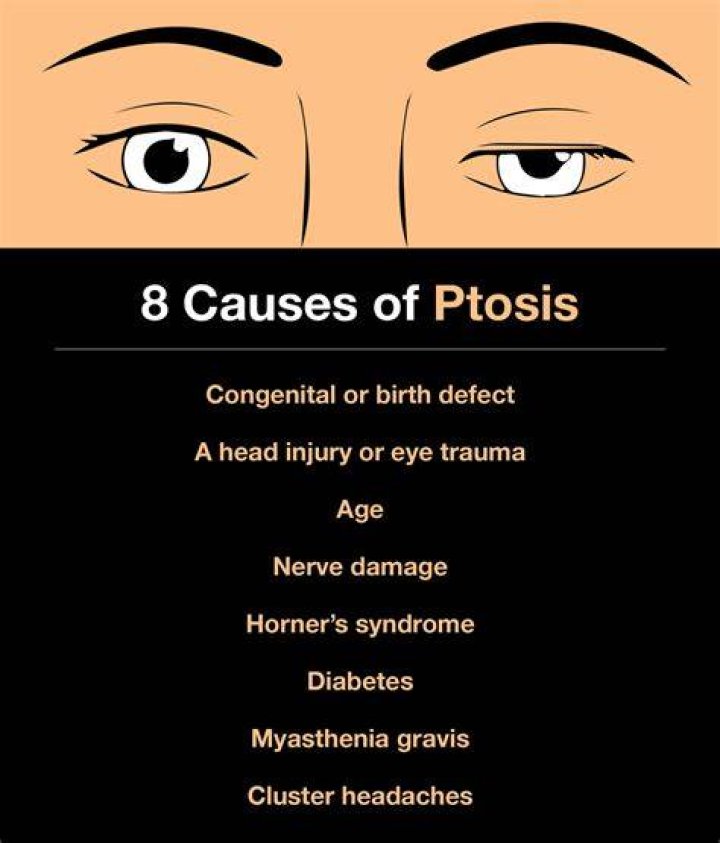 What is the most common cause of ptosis?